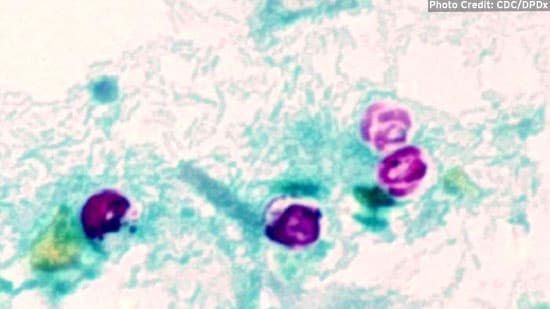 Cryptosporiduim